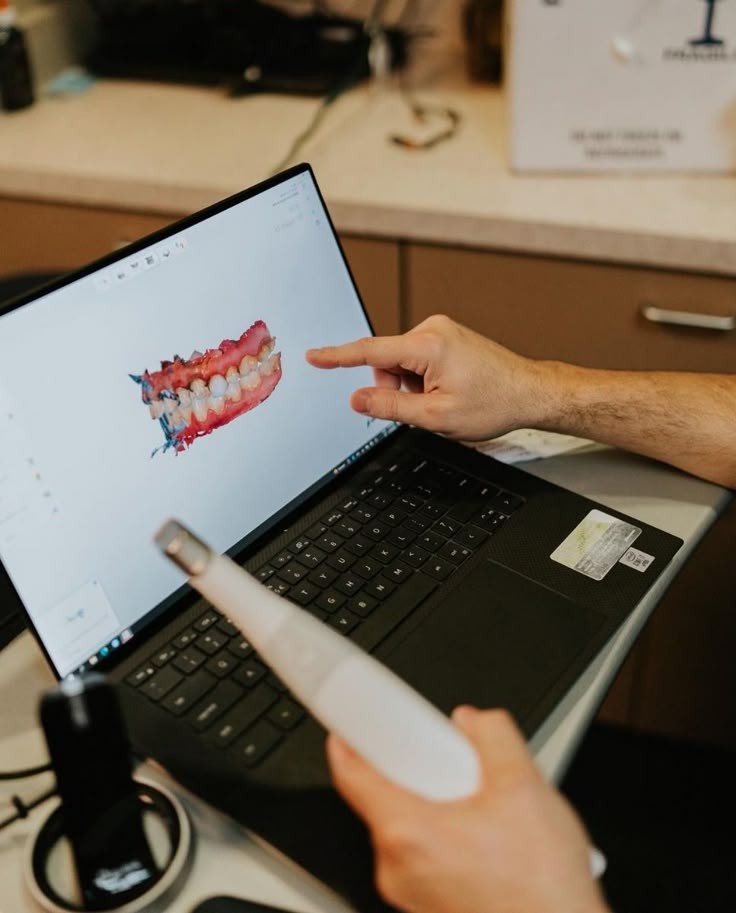 Dentista analisando escaneamento intraoral em notebook com scanner em mãos